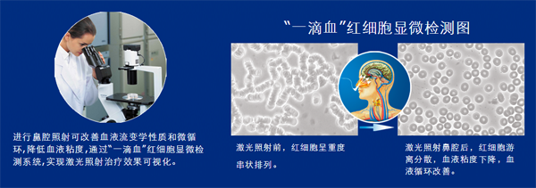 生活中哪些現(xiàn)象說明你的血液粘稠？-激光理療儀“一滴血”實驗-康興醫(yī)療器械官網(wǎng)