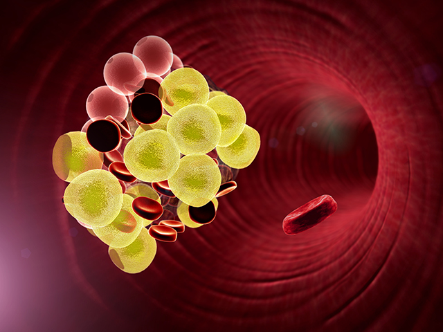 脂肪粒、內(nèi)臟脂肪、身體情況-康興醫(yī)療器械官網(wǎng)